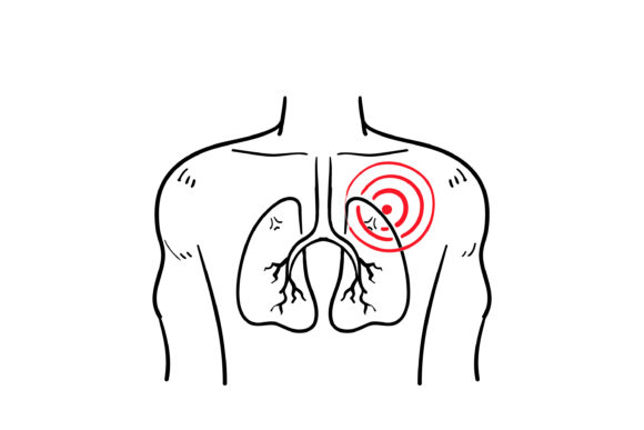 Download Doodle  Pneumonia Icon - Pneumonia Collection